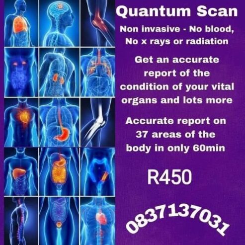 QUANTUM RESONANCE ANALYZER