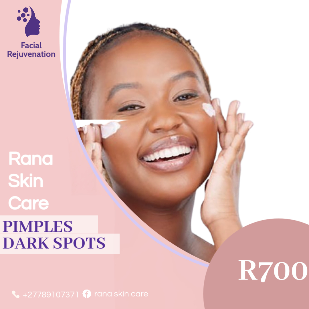 Pimples and dark spots removal